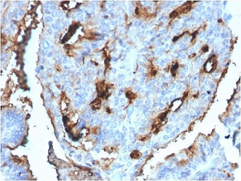 CDC34 Antibody