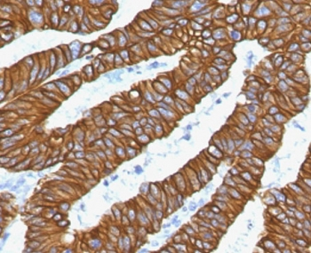 Recombinant Keratin 18 Antibody / Cytokeratin 18