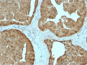GLO1 Antibody