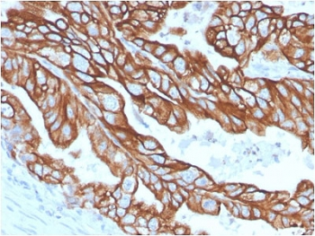 Recombinant CK18 Antibody / Cytokeratin 18