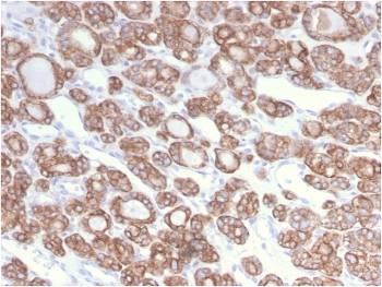 Recombinant CK18 Antibody / Cytokeratin 18