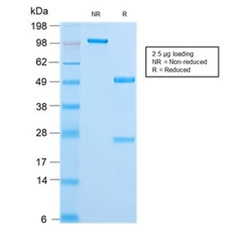Recombinant CK18 Antibody / Cytokeratin 18