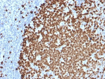 Ki67 Antibody