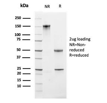 Ki67 Antibody