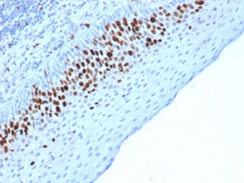 Ki67 Antibody