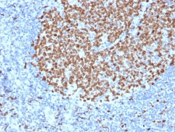 Ki67 Antibody
