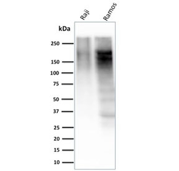 Ki67 Antibody