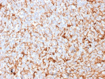 Recombinant Mammaglobin Antibody / SCGB2A2
