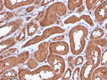 Recombinant MTAP Antibody / S-methyl-5'-thioadenosine phosphorylase