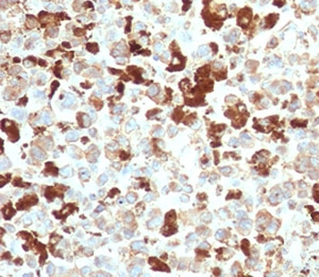 Recombinant NGFR Antibody / p75NTR
