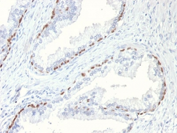 p63 Antibody
