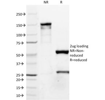p63 Antibody