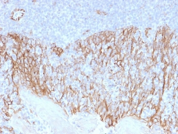 Beta Catenin Antibody