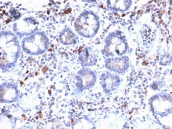 Recombinant MUC3 Antibody
