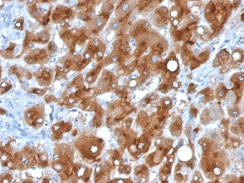 SAA Antibody / SAA1 + SAA2