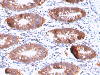 Recombinant Aurora B Antibody / AURKB
