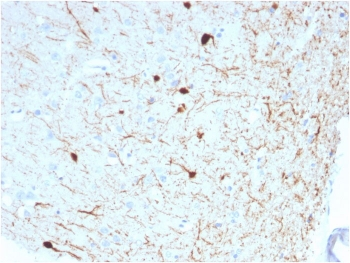 Calbindin 2 Antibody / CALB2 / Calretinin