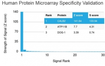 Calbindin 2 Antibody / CALB2 / Calretinin