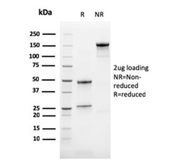 Calbindin 2 Antibody / CALB2 / Calretinin