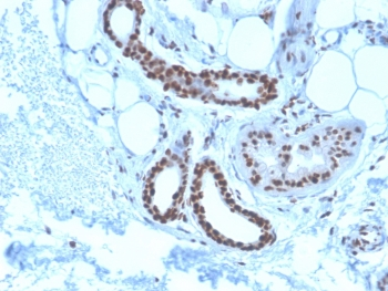 Nucleophosmin Antibody / NPM1
