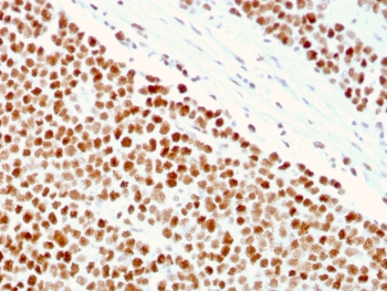 MSH6 Antibody