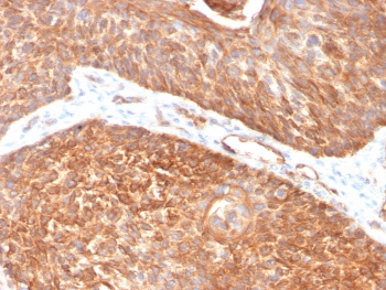 Cytokeratin 5 Antibody / KRT5 / CK5
