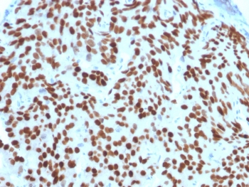 NKX3.1 Antibody