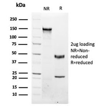 NKX3.1 Antibody