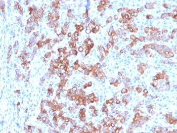 TIM3 Antibody / HAVCR2