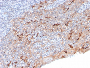 TIM3 Antibody / HAVCR2