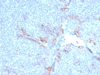 TIM3 Antibody / HAVCR2