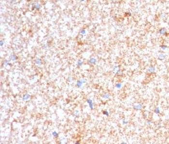 Serum Amyloid P Antibody