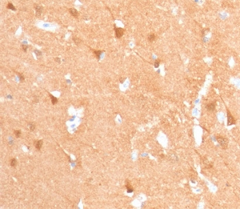 Recombinant UchL1 Antibody