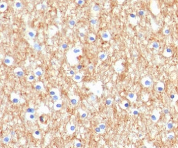 Drebrin 1 Antibody