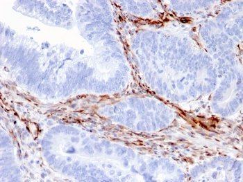 Nestin Antibody