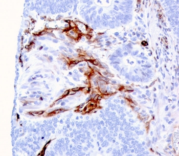 Nestin Antibody