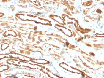 Recombinant EPO Antibody / Erythropoietin