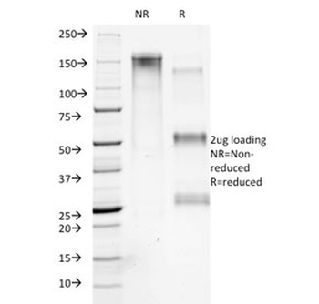 Collagen VII antibody / COL7A1
