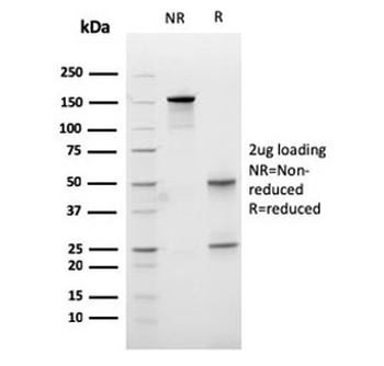 Carboxypeptidase A1 Antibody / CPA1