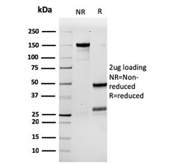 Recombinant Granulocyte-Colony Stimulating Factor Antibody / CSF3