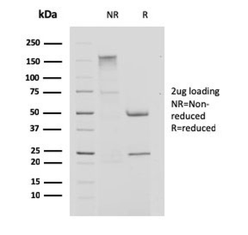 Cystatin A Antibody / CSTA