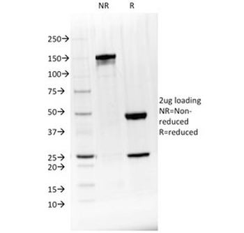 BTLA Antibody / CD272