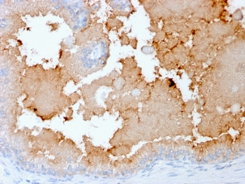 Recombinant AKT1 Antibody