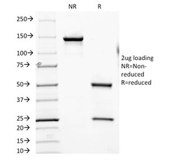 FOLH1 Antibody / Folate Hydrolase 1