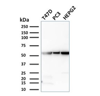 Glucose 6-Phosphate Isomerase Antibody / GPI
