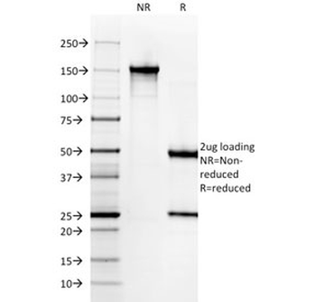 Recombinant Histone H1 Antibody
