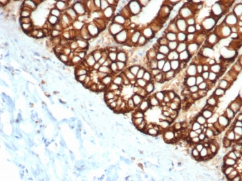 EpCAM Antibody