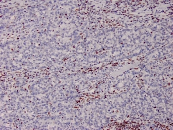 MSH2 Antibody