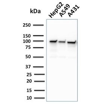 MSH2 Antibody