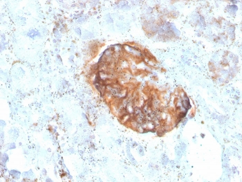 Recombinant MTAP Antibody / S-methyl-5'-thioadenosine phosphorylase